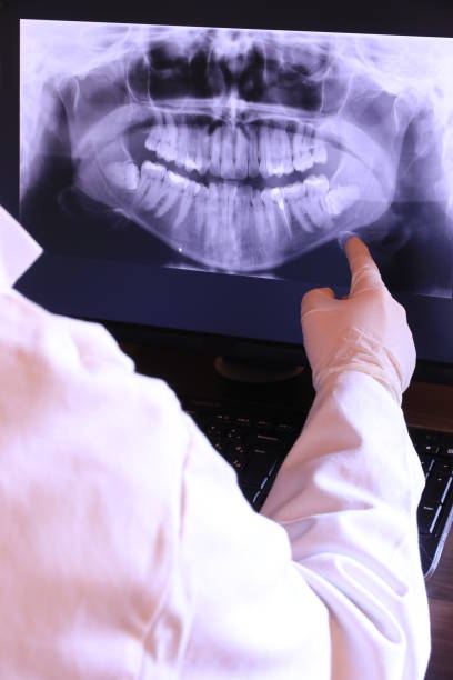Best Emergency Dentist for Lost Fillings or Crowns in Galva, KS