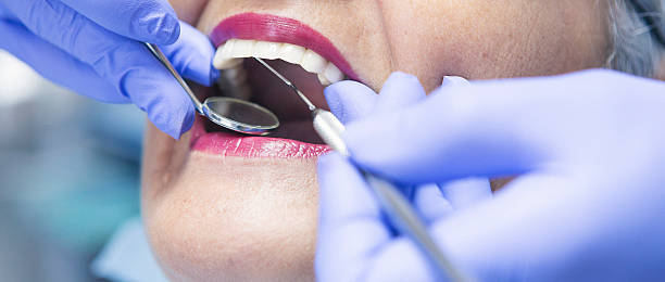 Best Broken or Cracked Tooth Emergency Dentist in Galva, KS